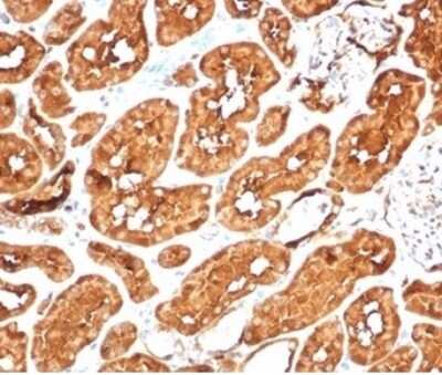 Immunohistochemistry-Paraffin: Aldehyde Dehydrogenase 1-A1/ALDH1A1 Antibody (ALDH1A1/7011R) [NBP3-13880]