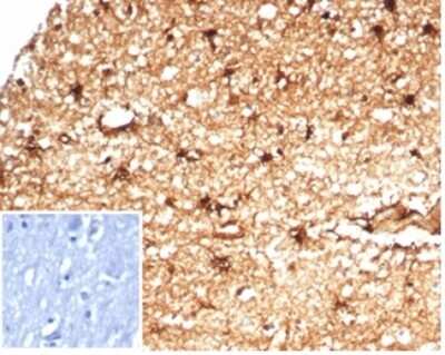 Immunohistochemistry-Paraffin: Aldehyde Dehydrogenase 1-A1/ALDH1A1 Antibody (ALDH1A1/7011R) [NBP3-13880]