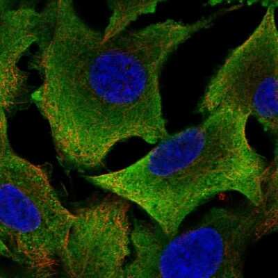 Immunocytochemistry/ Immunofluorescence: Aldehyde Dehydrogenase 1-A1/ALDH1A1 Antibody [NBP1-89152]