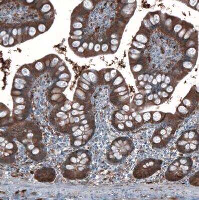 Immunohistochemistry-Paraffin: Aldehyde Dehydrogenase 1-A1/ALDH1A1 Antibody [NBP1-89152]