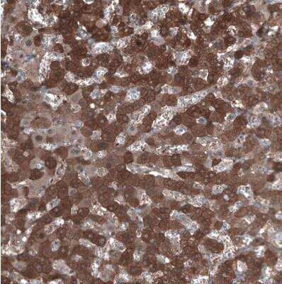 Immunohistochemistry-Paraffin: Aldehyde Dehydrogenase 1-A1/ALDH1A1 Antibody [NBP1-89152]