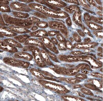 Immunohistochemistry-Paraffin: Aldehyde Dehydrogenase 1-A1/ALDH1A1 Antibody [NBP1-89152]