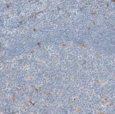 Immunohistochemistry-Paraffin: Aldehyde Dehydrogenase 1-A1/ALDH1A1 Antibody [NBP1-89152]