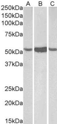 Western Blot: Aldehyde Dehydrogenase 1-A1/ALDH1A1 Antibody [NB100-787]