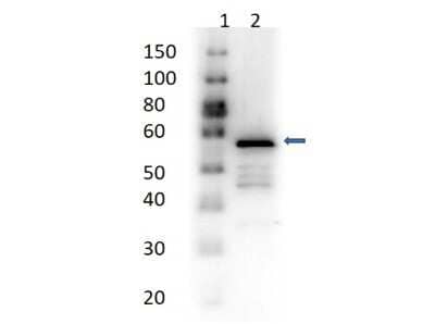 Western Blot: Aldehyde Dehydrogenase 1-A1/ALDH1A1 Antibody [NB600-914]