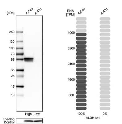 Western Blot: Aldehyde Dehydrogenase 1-A1/ALDH1A1 Antibody [NBP1-89152]