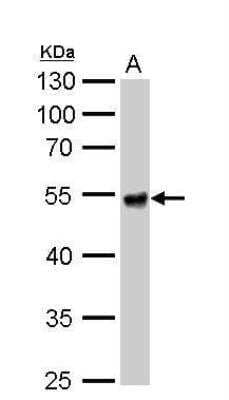 Western Blot: Aldehyde Dehydrogenase 1-A1/ALDH1A1 Antibody [NBP2-15334]