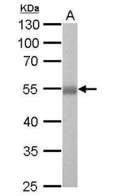 Western Blot: Aldehyde Dehydrogenase 1-A1/ALDH1A1 Antibody [NBP2-15334]