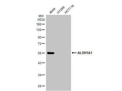 Western Blot: Aldehyde Dehydrogenase 1-A1/ALDH1A1 Antibody [NBP2-15336]