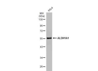 Western Blot: Aldehyde Dehydrogenase 1-A1/ALDH1A1 Antibody [NBP2-15336]