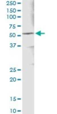 Immunoprecipitation: Aldehyde Dehydrogenase 3-A1/ALDH3A1 Antibody (2G4) [H00000218-M08]