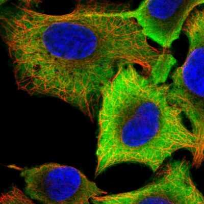Immunocytochemistry/ Immunofluorescence: Aldehyde Dehydrogenase 3-A1/ALDH3A1 Antibody [NBP2-47551]