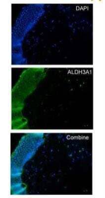 Immunohistochemistry-Frozen: Aldehyde Dehydrogenase 3-A1/ALDH3A1 Antibody [NBP2-15340]