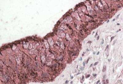 Immunohistochemistry-Paraffin: Aldehyde Dehydrogenase 3-A1/ALDH3A1 Antibody [NBP1-52052]