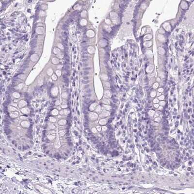 Immunohistochemistry-Paraffin: Aldehyde Dehydrogenase 3-A1/ALDH3A1 Antibody [NBP2-47551]