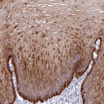 Immunohistochemistry-Paraffin: Aldehyde Dehydrogenase 3-A1/ALDH3A1 Antibody [NBP2-47551]