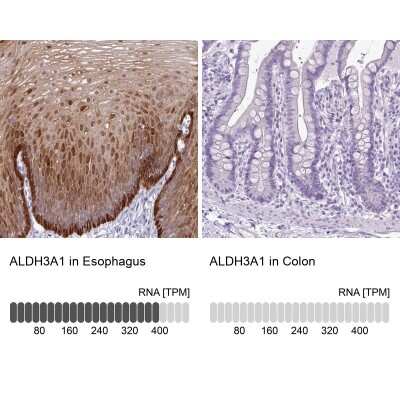 Immunohistochemistry-Paraffin: Aldehyde Dehydrogenase 3-A1/ALDH3A1 Antibody [NBP2-47551]