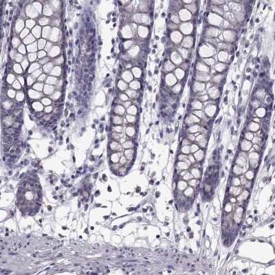 Immunohistochemistry-Paraffin: Aldehyde Dehydrogenase 3-A1/ALDH3A1 Antibody [NBP2-55797]