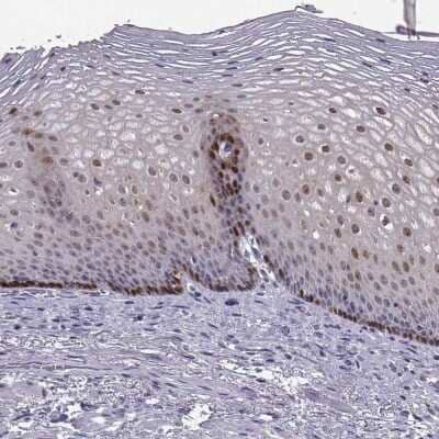 Immunohistochemistry-Paraffin: Aldehyde Dehydrogenase 3-A1/ALDH3A1 Antibody [NBP2-55797]