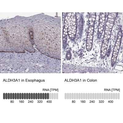 Immunohistochemistry-Paraffin: Aldehyde Dehydrogenase 3-A1/ALDH3A1 Antibody [NBP2-55797]