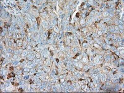 Immunohistochemistry: Aldehyde Dehydrogenase 3-A1/ALDH3A1 Antibody (OTI1B6) - Azide and BSA Free [NBP2-70152]