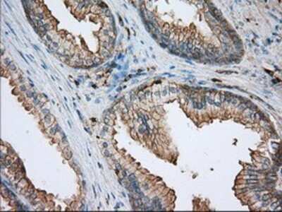 Immunohistochemistry: Aldehyde Dehydrogenase 3-A1/ALDH3A1 Antibody (OTI1B6) - Azide and BSA Free [NBP2-70152]