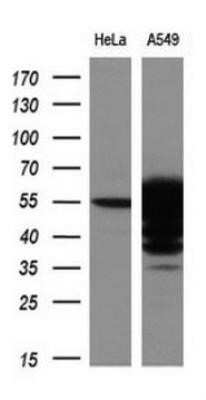 Western Blot: Aldehyde Dehydrogenase 3-A1/ALDH3A1 Antibody (OTI1B6)Azide and BSA Free [NBP2-70152]