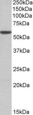 Western Blot: Aldehyde Dehydrogenase 3-A1/ALDH3A1 Antibody [NBP1-52052]