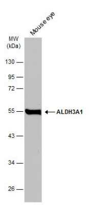 Western Blot: Aldehyde Dehydrogenase 3-A1/ALDH3A1 Antibody [NBP2-15340]