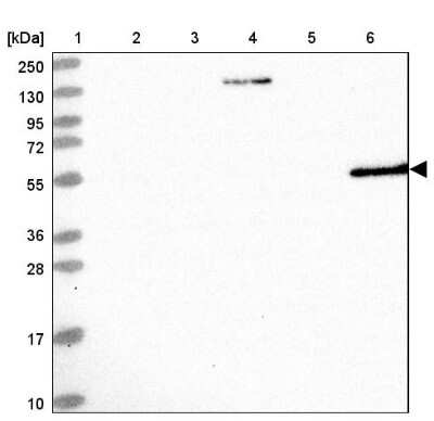 Western Blot: Aldehyde Dehydrogenase 3-A1/ALDH3A1 Antibody [NBP2-47551]