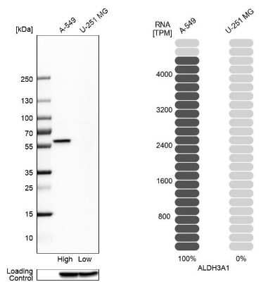 Western Blot: Aldehyde Dehydrogenase 3-A1/ALDH3A1 Antibody [NBP2-47551]
