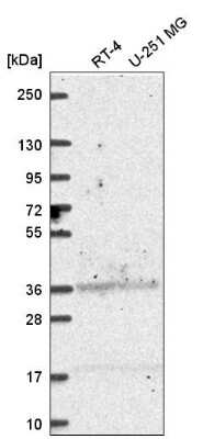 Western Blot: Aldehyde Dehydrogenase 3-A1/ALDH3A1 Antibody [NBP2-55797]