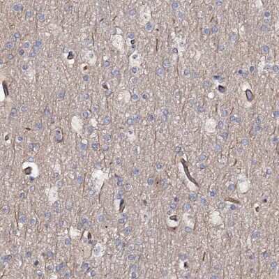 Immunohistochemistry-Paraffin: Aldehyde Oxidase 1/AOX1 Antibody [NBP1-89070]
