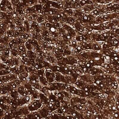 Immunohistochemistry-Paraffin: Aldehyde Oxidase 1/AOX1 Antibody [NBP1-89070]