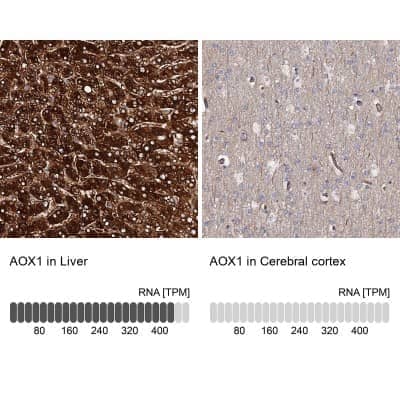 Immunohistochemistry-Paraffin: Aldehyde Oxidase 1/AOX1 Antibody [NBP1-89070]