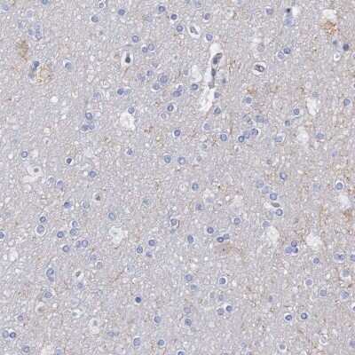 Immunohistochemistry-Paraffin: Aldehyde Oxidase 1/AOX1 Antibody [NBP1-89071]