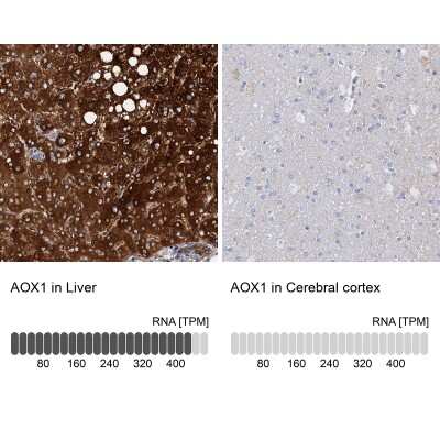 Immunohistochemistry-Paraffin: Aldehyde Oxidase 1/AOX1 Antibody [NBP1-89071]