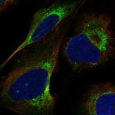 Immunocytochemistry/ Immunofluorescence: Aldehyde dehydrogenase 5 Antibody [NBP3-17798]
