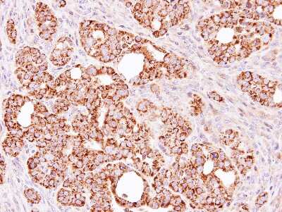 Immunohistochemistry-Paraffin: Aldehyde dehydrogenase 5 Antibody [NBP1-32569]