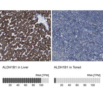 Immunohistochemistry-Paraffin: Aldehyde dehydrogenase 5 Antibody [NBP1-90192]