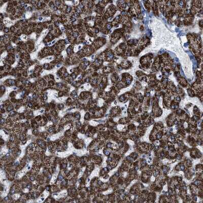Immunohistochemistry-Paraffin: Aldehyde dehydrogenase 5 Antibody [NBP1-90192]