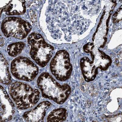 Immunohistochemistry-Paraffin: Aldehyde dehydrogenase 5 Antibody [NBP1-90192]