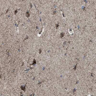 Immunohistochemistry-Paraffin: Aldehyde dehydrogenase 5 Antibody [NBP1-90192]