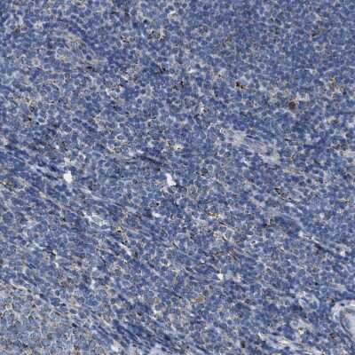 Immunohistochemistry-Paraffin: Aldehyde dehydrogenase 5 Antibody [NBP1-90192]