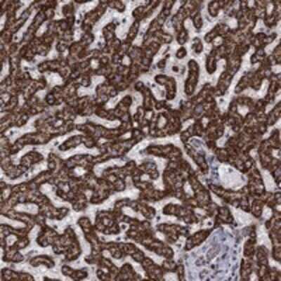 Immunohistochemistry-Paraffin: Aldehyde dehydrogenase 5 Antibody [NBP3-17798]
