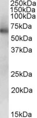 Western Blot: Aldehyde dehydrogenase 5 Antibody [NBP1-52053]