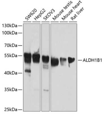 Western Blot: Aldehyde dehydrogenase 5 AntibodyBSA Free [NBP2-92430]