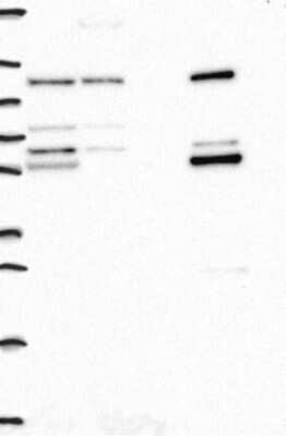 Western Blot: Aldehyde dehydrogenase 5 Antibody [NBP3-17798]