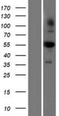 Western Blot: Aldehyde dehydrogenase 5 Overexpression Lysate [NBP2-10694]