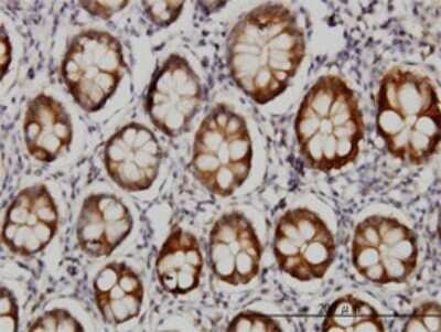 Immunohistochemistry-Paraffin: Aldo-keto Reductase 1B10/AKR1B10 Antibody (1A6) [H00057016-M01]